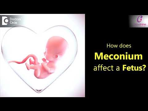 Meconium Stained Amniotic Fluid and Effects on Baby |Thick & Thin Meconium-Dr.Brunda Channappa of C9