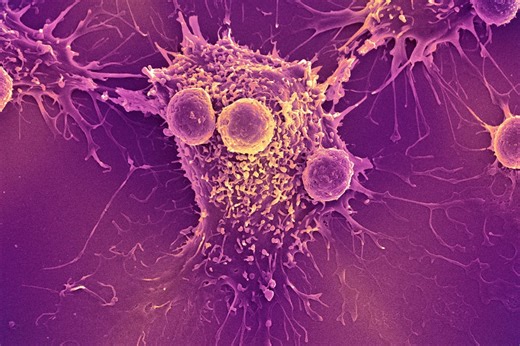 COVID-19 mRNA vaccines could unlock the next revolution in cancer treatment – new research