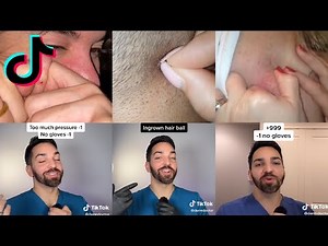 Pimple popping | Dermdoctor | Pimple extraction | TikTok Compilation 2022