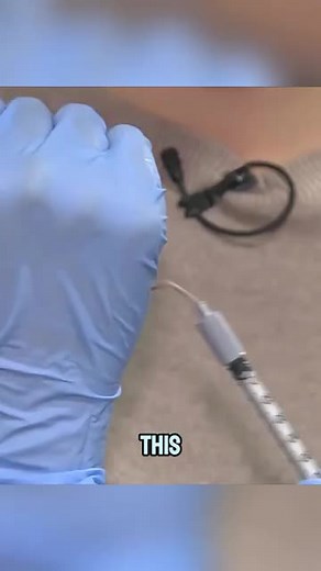 The World’s Softest Syringe Needle — How It Works❓💉 | Needle Felting