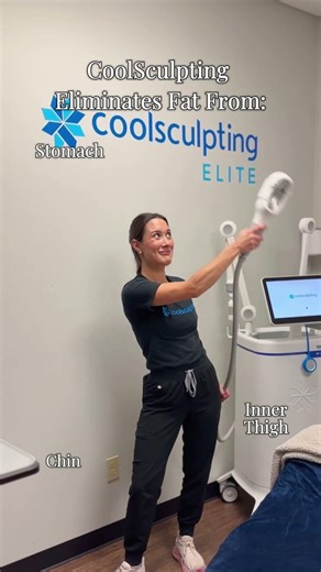 Did You Know? #coolsculpting #shreveport #shreveportbossier