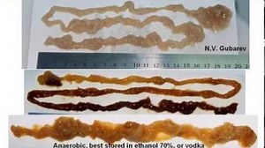 Donate to Rope worms full genome sequencing, organized by Alex Volinsky