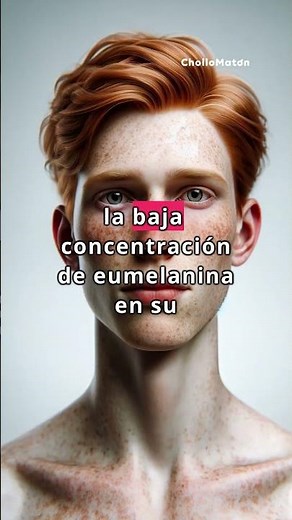 The most special characteristics and curiosities of redheads #redheads