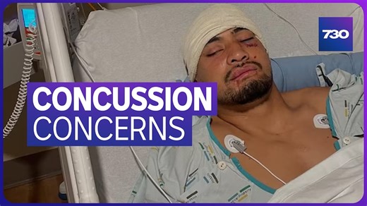 Is the NRL doing enough to identify potential concussions?