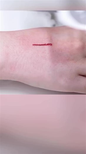 Parches Impermeables para Cierre de Heridas Rápido