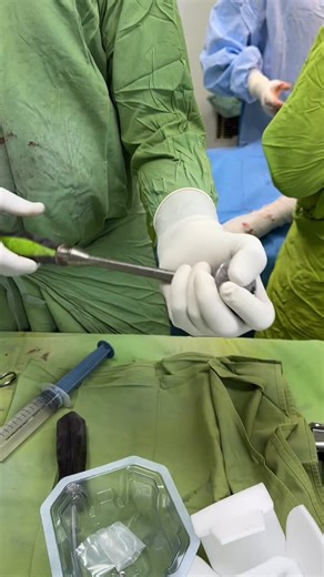 Ashish Dewan on Instagram: "🔹 Guess the Implant? 📍 Join Dr. Ashish Dewan in exploring the brilliance behind orthopedic implants and surgical mastery. 👨‍⚕️ Let’s see who gets it right! 📞 Book your consultation with Dr. Ashish Dewan today! Best Orthopaedic and Joint Replacement Surgeon in Noida A-289, Sector -43, Noida , Uttar Pradesh 📞9810140531 🌐 www.drashishdewan.com #OrthopedicExpert #KneeSurgery #GuessTheImplant #OrthoCare #SurgicalSkill #ImplantChallenge #BoneHealth #OperationRoom #Ree