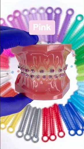 Rainbow Braces , Orthodontics