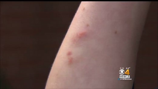 33K views · 100 reactions | Those gypsy moth caterpillars aren't just...