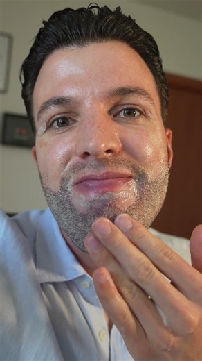 5 GIORNI POST TRAPIANTO DI BARBA