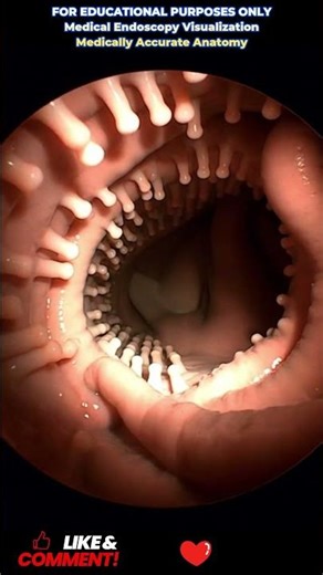 #MedicalEducation #HumanAnatomy #Endoscopy