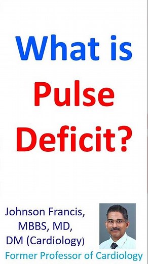 What is pulse deficit?
