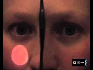 Ophtalmologie - Réflexe Pupillaire