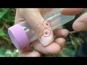 ヤバい殺人ダニに襲われた