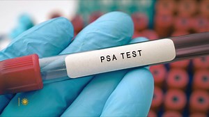 CBS News Sunday Morning:The prostate, and why it causes so many problems for men