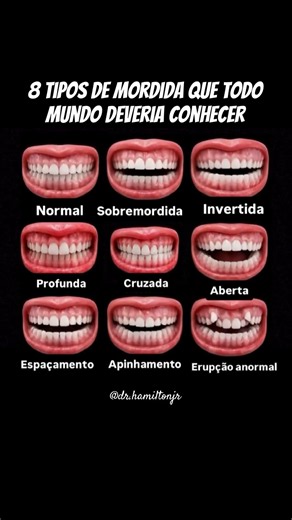 Qual é o seu tipo de mordida? Descubra em 30 segundos!