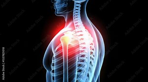 Understanding Shoulder Pain Anatomy A detailed medical illustration reveals the complex structure of the human shoulder joint highlighting potential pain areas for accurate diagnosis and treatment.