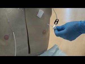 implantable ports CVADS