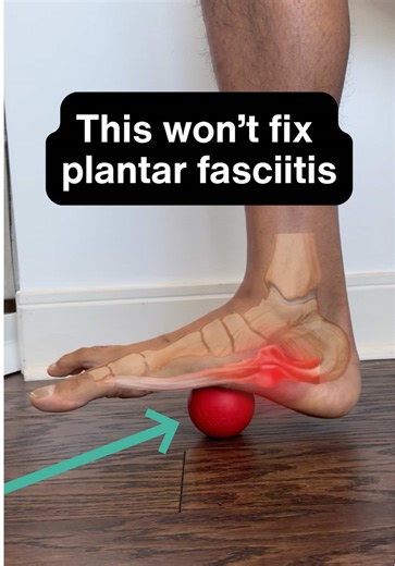 Rolling your foot for plantar fasciitis might feel good, but it doesn’t fix the root cause. In most cases, plantar fasciitis isn’t just tight tissue, it’s a load tolerance problem. If the plantar fascia and calf can’t handle daily stress, pain keeps coming back. That’s why progressive loading, like single-leg calf raises, matters. Strength improves tissue capacity and leads to long-term relief, not just temporary symptom relief. #plantarfasciitis #heelpain #footpain #physiotherapy #calfstrength