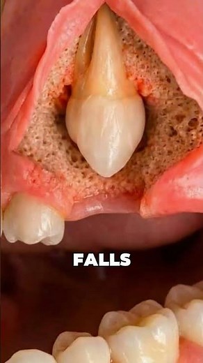 Why Do Baby Teeth Fall Out? 🦷 | How Adult Teeth Grow In