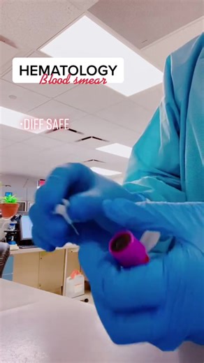 Mastering Blood Smear Techniques for Accurate Diagnosis