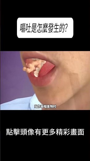 嘔吐是怎麼發生的？#科普 #漲知識