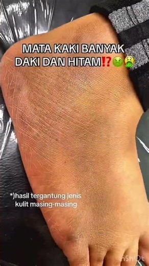 Deep Cleansing Remove Dust dust Dead Skin #ameenbeautytips ‪@GlowAndCleanByAmeen‬