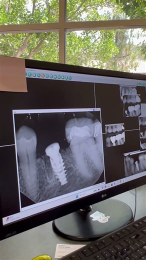 What Dentists Do Between Patients | Dr. Pedram at Gentle Dentistry of Poway