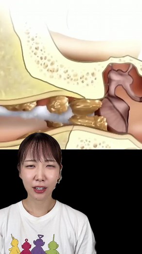耳垢ごっそり取り！耳掃除検証動画