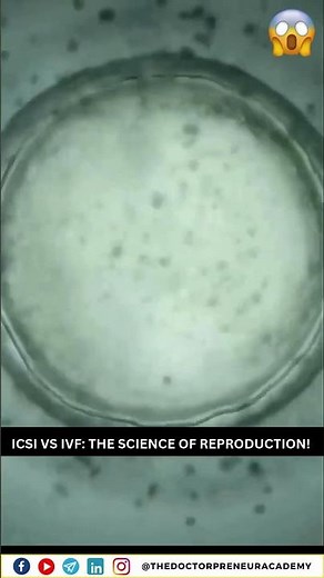 ICSI vs IVF Explained: Which is Right for You?