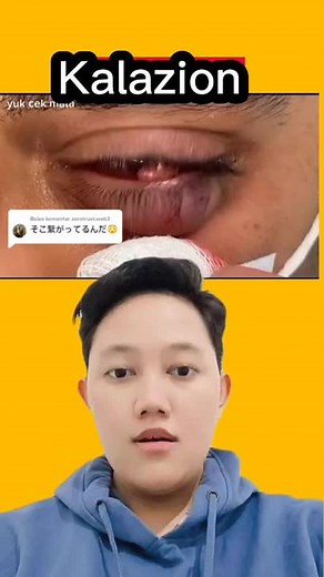 Understanding Red Eye Causes and Care Tips