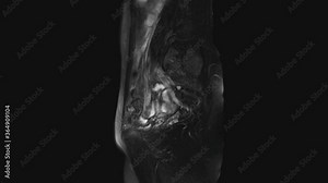 MRI of the female pelvic organs, abdominal cavity, gastrointestinal tract and bladder