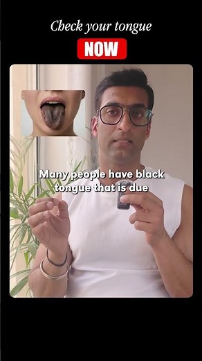what your tongue color says about your health!