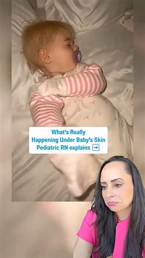 If your child has eczema you need to know this