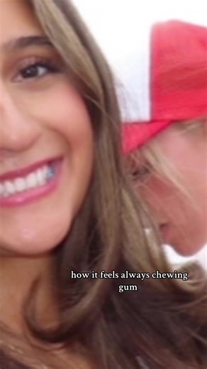 Understanding Jaw Issues from Chewing Gum