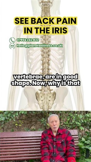 Iridology and Back Pain #iridology #backpain