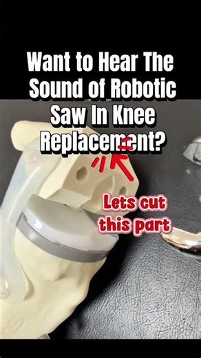 Raw OR audio: robotic saw through bone