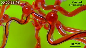 Watch this worm robot developed to wiggle its way through arteries in your brain. Read the full story for free here https://www.newscientist.com/article/2214657-worm-robot-could-wiggle-its-way-through-arteries-in-the-brain/ | New Scientist
