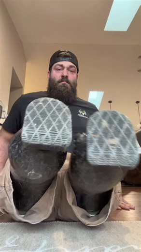 Stubby chronicles update #limblossboss #dreamteamprosthetics #myleglesslife