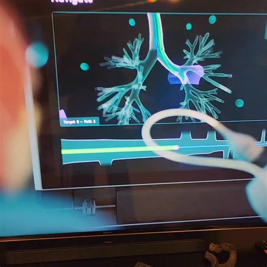 Temple Lung Center commercial