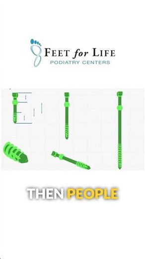 Foot Surgery… But Without Permanent Metal