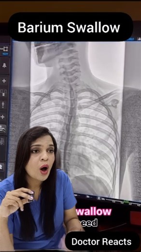 Dr Ramya Nalli | ENT, Sleep & Facial Cosmetic Surgeon 🔵 | A Barium Swallow is a special X-ray test used to visualize the esophagus and diagnose swallowing disorders, reflux, and other conditions.... | Instagram