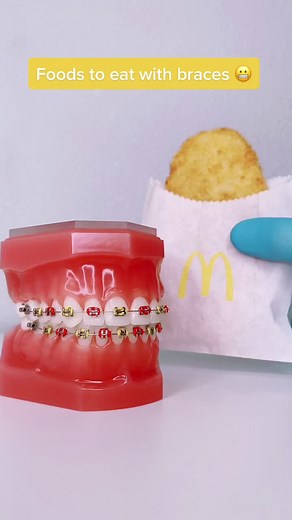 Best Breakfast Items from McDonald's for Braces