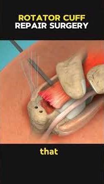 ROTATOR CUFF REPAIR SURGERY #3danatomy #anatomy3d # #scienceshorts #goviral
