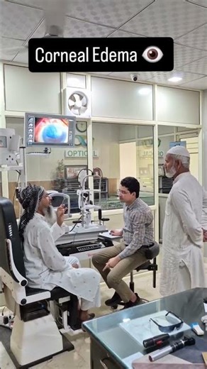 Corneal edema After Cataract surgery by ( Dr.Najmul khan)Noushaba memorial eye care center katai