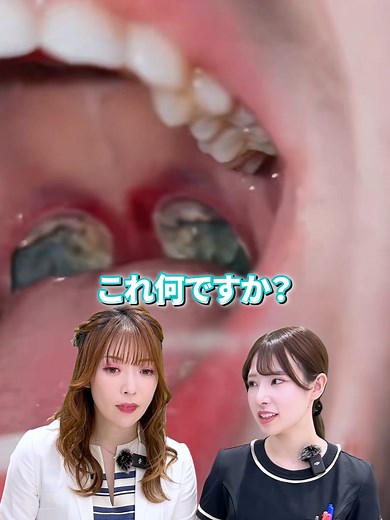 扁桃腺手術を受けるメリットと体験談