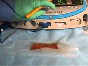 Conmed System 5000 ESU Demo 0001