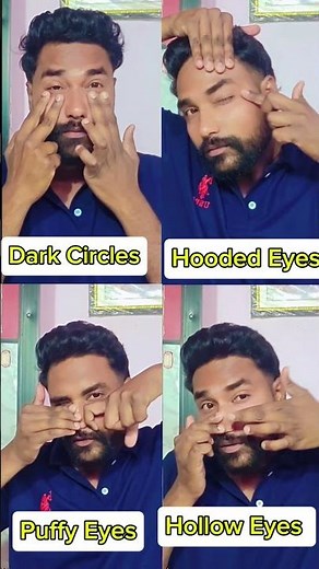 How to Remove Dark Circles, Puffy Eyes & Hooded Eyes Naturally | Face Yoga for Bright Eyes & Under