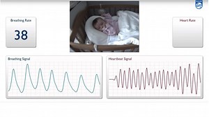 Cette caméra Philips surveille les signes vitaux des patients... rien qu'en les filmant