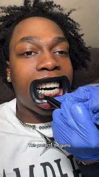 This is your sign to get YOUR TEETH WHITENED😁