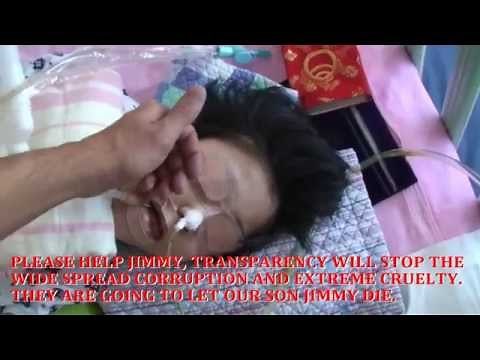 WARNING: Graphic, Child Suffocated by Japanese Doctors with plastic bag may be upsetting